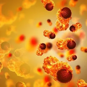 cervical cancer