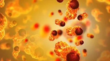 cervical cancer
